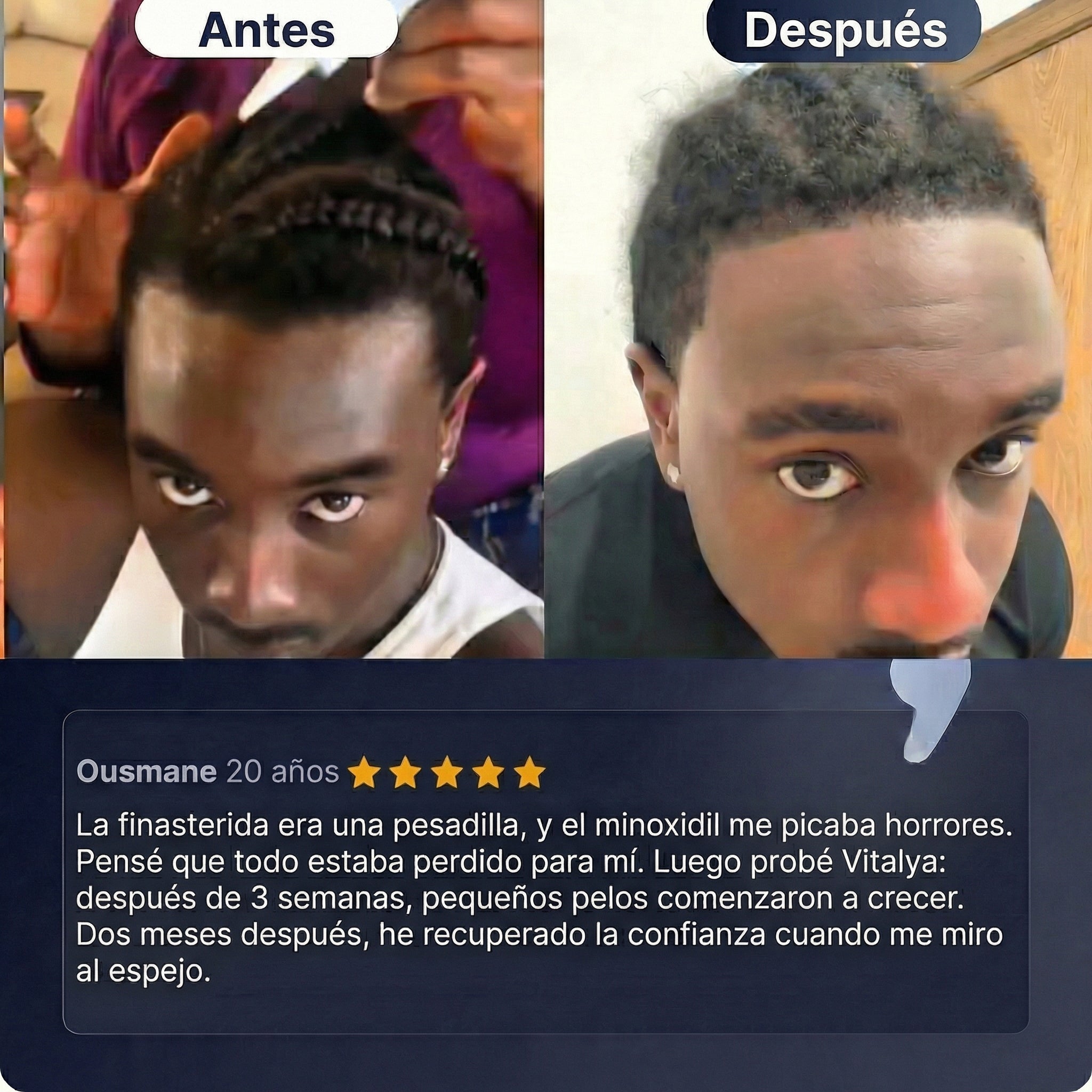 Vitalya- Sérum recrecimiento capilar